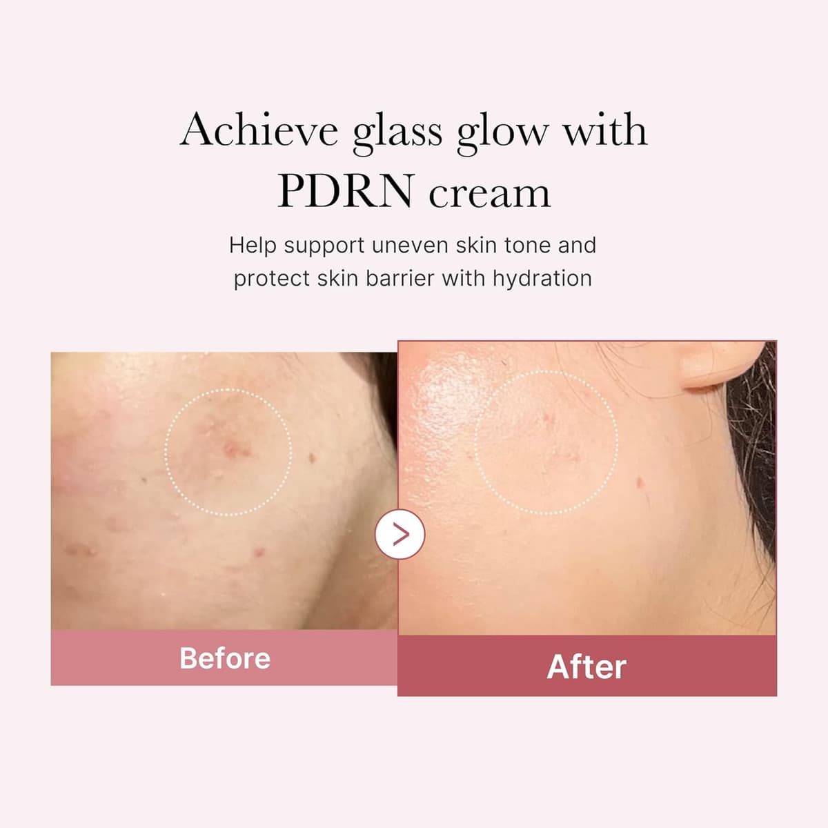 Medicube PDRN Pink Hyaluronic Moisturizing Cream (Exp - Nov/27)
