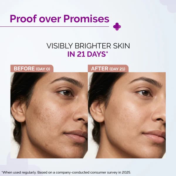 The Derma Co 10% Vitamin C Serum